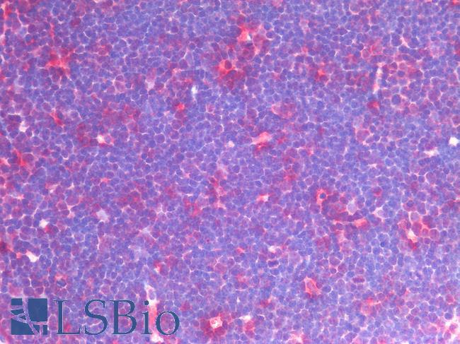 CD33 Antibody - Human Thymus: Formalin-Fixed, Paraffin-Embedded (FFPE)