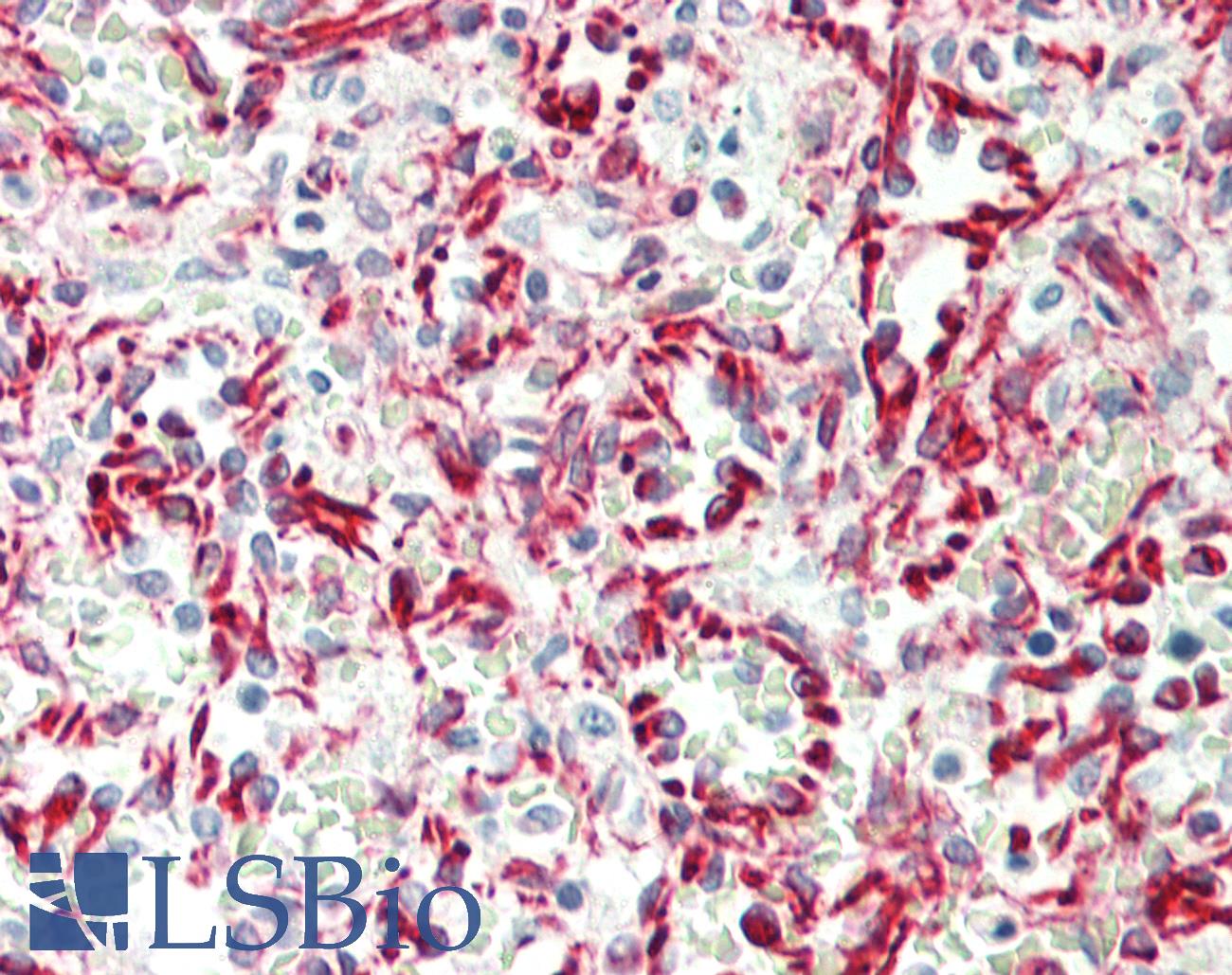 CD34 Antibody - Human Spleen: Formalin-Fixed, Paraffin-Embedded (FFPE)
