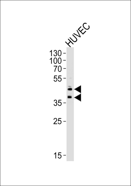 CD34 Antibody - Western blot of lysate from HUVEC cell line, using CD34 Antibody. Antibody was diluted at 1:1000 at each lane. A goat anti-rabbit IgG H&L (HRP) at 1:5000 dilution was used as the secondary antibody. Lysate at 35ug per lane.