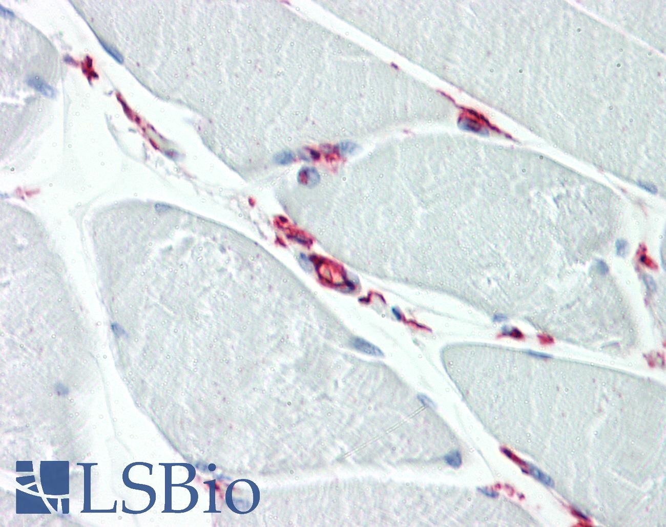 CD34 Antibody - Human Skeletal Muscle: Formalin-Fixed, Paraffin-Embedded (FFPE)
