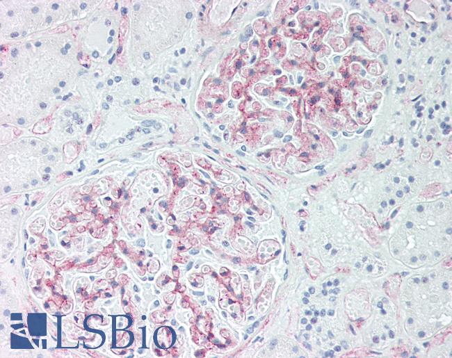 CD34 Antibody - Human Kidney: Formalin-Fixed, Paraffin-Embedded (FFPE)