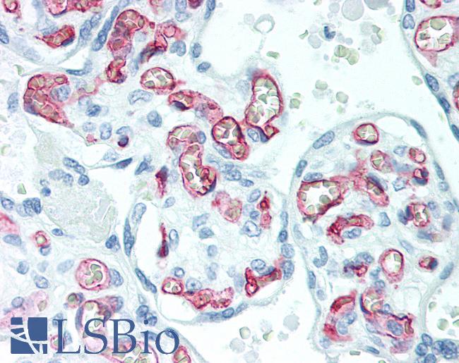 CD34 Antibody - Human Placenta: Formalin-Fixed, Paraffin-Embedded (FFPE)