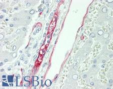 CD34 Antibody - Human Liver: Formalin-Fixed, Paraffin-Embedded (FFPE)