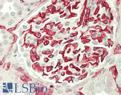 CD34 Antibody - Human Kidney: Formalin-Fixed, Paraffin-Embedded (FFPE)