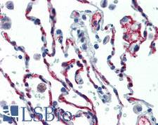 CD34 Antibody - Anti-CD34 antibody IHC of human lung. Immunohistochemistry of formalin-fixed, paraffin-embedded tissue after heat-induced antigen retrieval. Antibody dilution 1:50. This image was taken for the unconjugated form of this product. Other forms have not been tested.