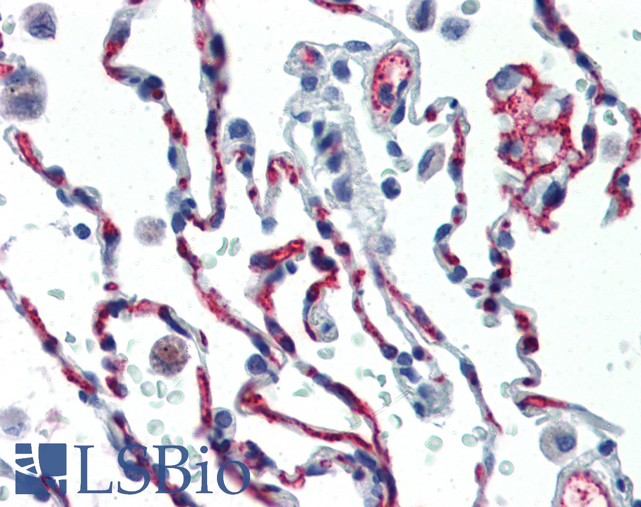 CD34 Antibody - Anti-CD34 antibody IHC of human lung. Immunohistochemistry of formalin-fixed, paraffin-embedded tissue after heat-induced antigen retrieval. Antibody dilution 1:50. This image was taken for the unconjugated form of this product. Other forms have not been tested.
