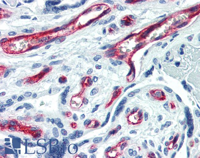 CD34 Antibody - Anti-CD34 antibody IHC of human placenta. Immunohistochemistry of formalin-fixed, paraffin-embedded tissue after heat-induced antigen retrieval. Antibody dilution 1:50. This image was taken for the unconjugated form of this product. Other forms have not been tested.