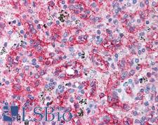 CD36 Antibody - Anti-CD36 antibody IHC of human spleen. Immunohistochemistry of formalin-fixed, paraffin-embedded tissue after heat-induced antigen retrieval. Antibody concentration 5 ug/ml.  This image was taken for the unconjugated form of this product. Other forms have not been tested.