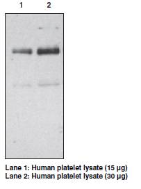CD36 Antibody - Bands located at 88 kD (glycosylated) and 54kD (non-glycosylated).