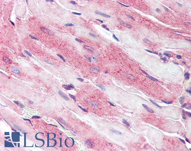 CD36 Antibody - Anti-CD36 antibody IHC of mouse heart. Immunohistochemistry of formalin-fixed, paraffin-embedded tissue after heat-induced antigen retrieval. Antibody at a dilution of 1:200.
