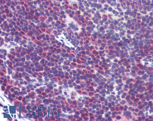 CD36 Antibody - Anti-CD36 antibody IHC of mouse spleen. Immunohistochemistry of formalin-fixed, paraffin-embedded tissue after heat-induced antigen retrieval. Antibody at a dilution of 1:200.
