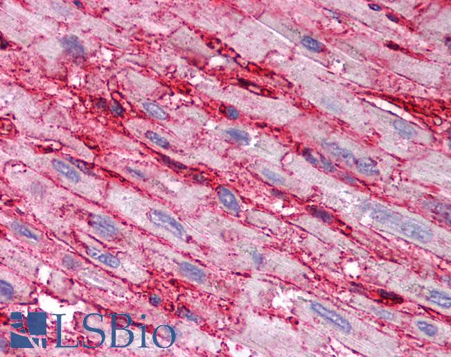 CD36 Antibody - Anti-CD36 antibody IHC of human heart. Immunohistochemistry of formalin-fixed, paraffin-embedded tissue after heat-induced antigen retrieval. Antibody at a dilution of 1:20.