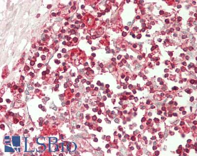 CD3E Antibody - Human Thymus: Formalin-Fixed, Paraffin-Embedded (FFPE)