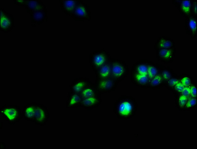 CD3E Antibody - Immunofluorescence staining of PC3 cells with CD3E Antibody at 1:53, counter-stained with DAPI. The cells were fixed in 4% formaldehyde, permeabilized using 0.2% Triton X-100 and blocked in 10% normal Goat Serum. The cells were then incubated with the antibody overnight at 4°C. The secondary antibody was Alexa Fluor 488-congugated AffiniPure Goat Anti-Rabbit IgG(H+L).