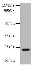 CD3E Antibody - Western blot All lanes: CD3E antibody at 1.5µg/ml + Jurkat whole cell lysate Secondary Goat polyclonal to rabbit IgG at 1/10000 dilution Predicted band size: 23 kDa Observed band size: 23 kDa