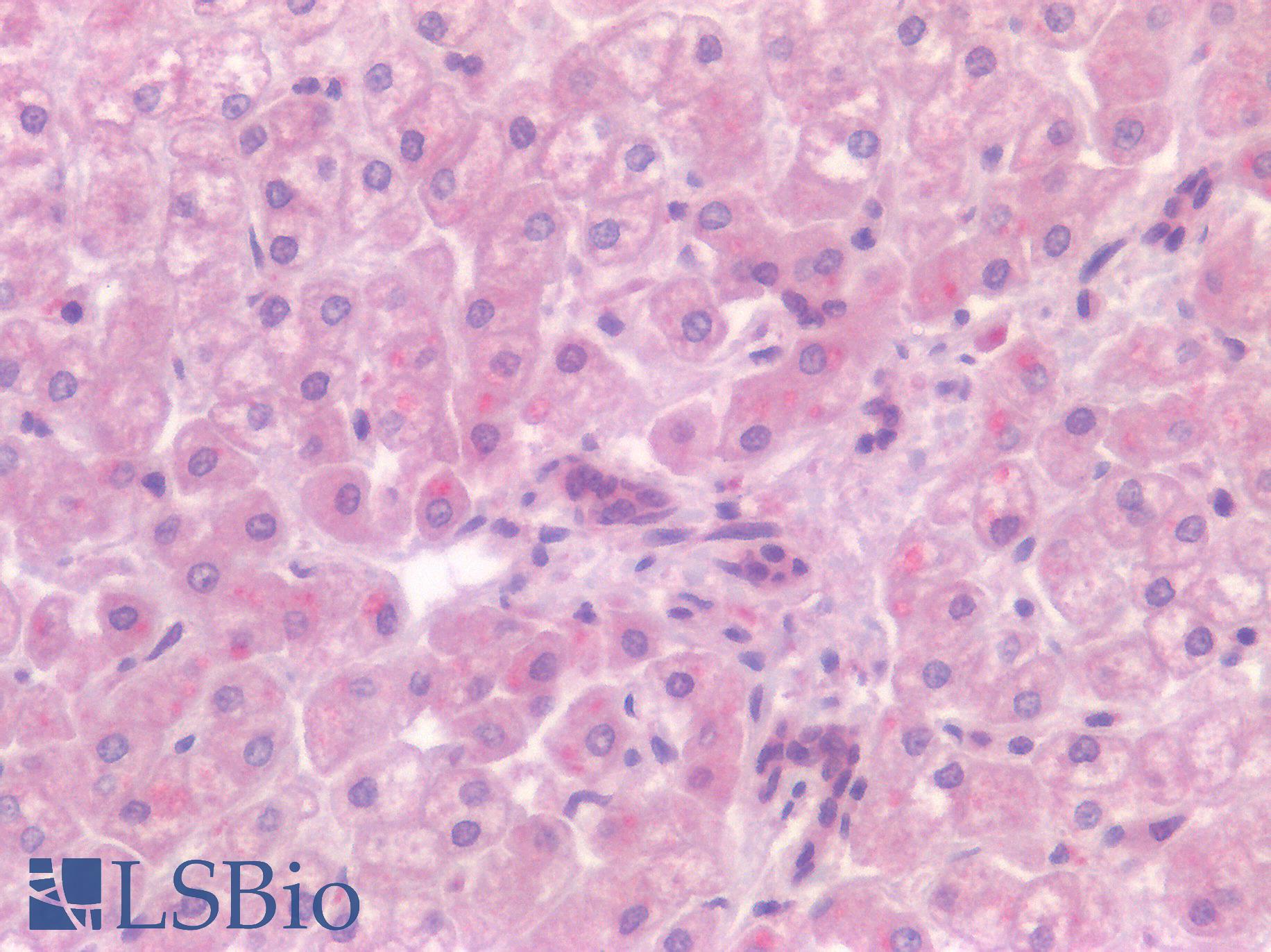 CD4 Antibody - Human Liver: Formalin-Fixed, Paraffin-Embedded (FFPE)