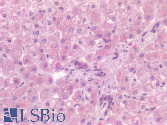 CD4 Antibody - Human Liver: Formalin-Fixed, Paraffin-Embedded (FFPE)