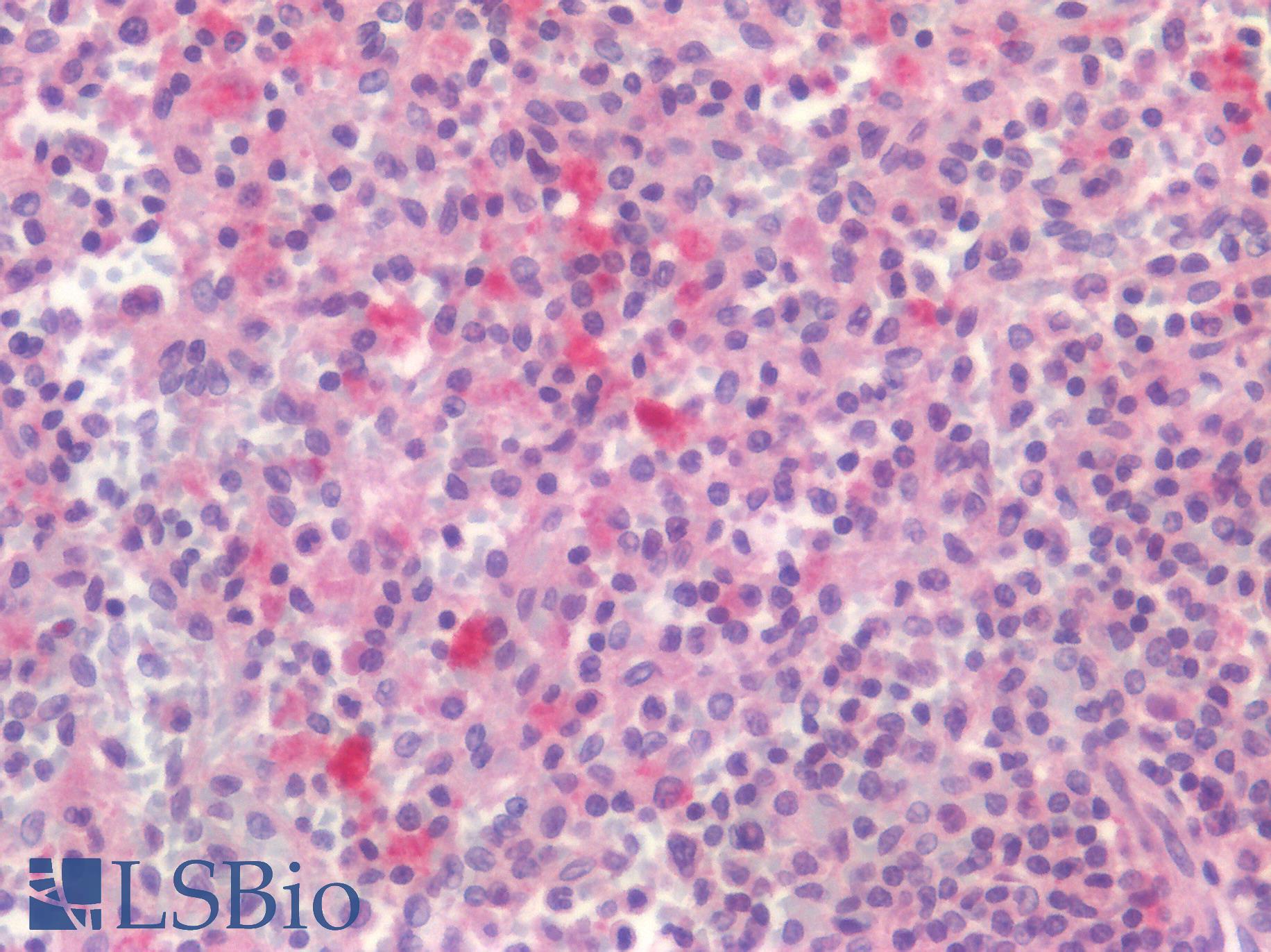 CD4 Antibody - Human Spleen: Formalin-Fixed, Paraffin-Embedded (FFPE)