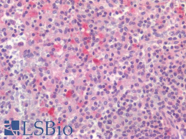 CD4 Antibody - Human Spleen: Formalin-Fixed, Paraffin-Embedded (FFPE)