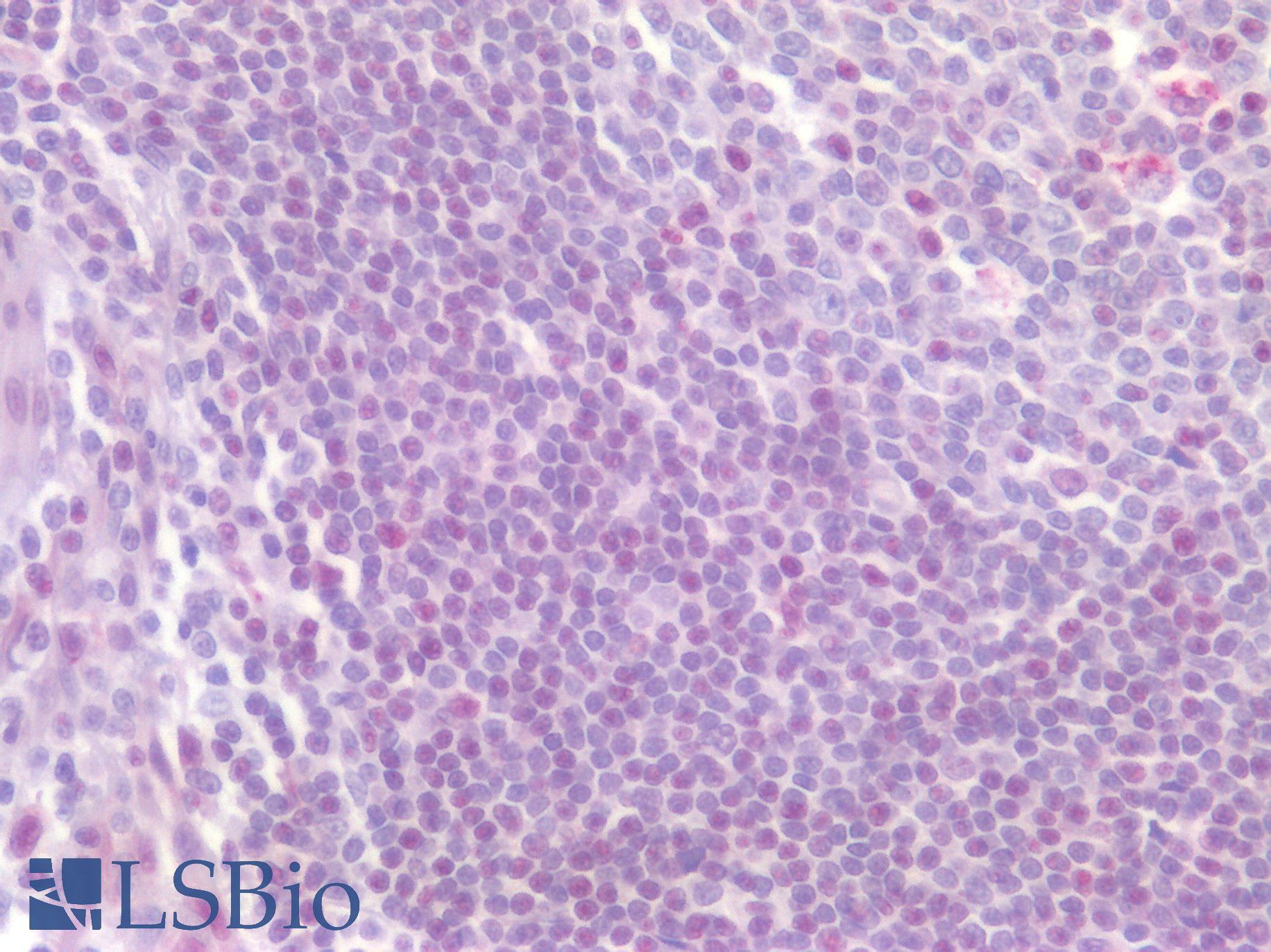 CD4 Antibody - Human Tonsil: Formalin-Fixed, Paraffin-Embedded (FFPE)