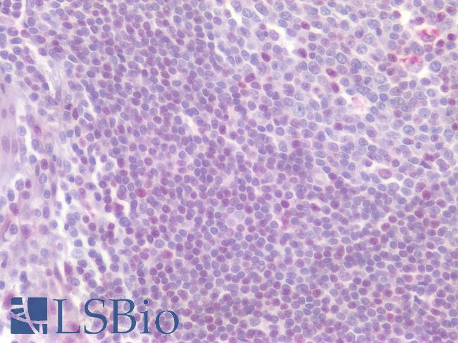 CD4 Antibody - Human Tonsil: Formalin-Fixed, Paraffin-Embedded (FFPE)