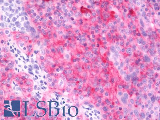 CD40 Antibody - Anti-CD40 antibody IHC staining of human tonsil. Immunohistochemistry of formalin-fixed, paraffin-embedded tissue after heat-induced antigen retrieval. Antibody concentration 10 ug/ml. This image was taken for the unmodified form of this product. Other forms have not been tested.