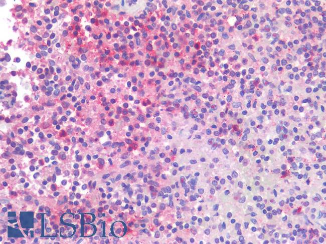 CD40 Antibody - Human Spleen: Formalin-Fixed, Paraffin-Embedded (FFPE)