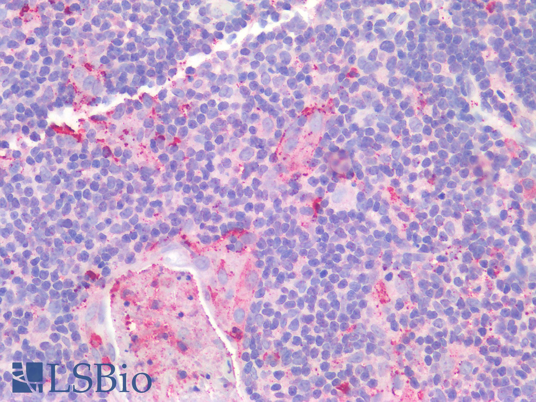 CD40 Antibody - Human Thymus: Formalin-Fixed, Paraffin-Embedded (FFPE)