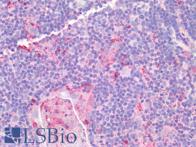 CD40 Antibody - Human Thymus: Formalin-Fixed, Paraffin-Embedded (FFPE)