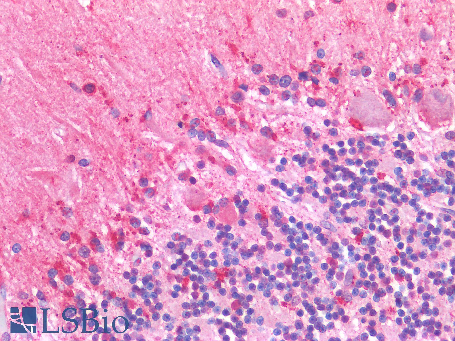 CD40 Antibody - Human Brain, Cerebellum: Formalin-Fixed, Paraffin-Embedded (FFPE)