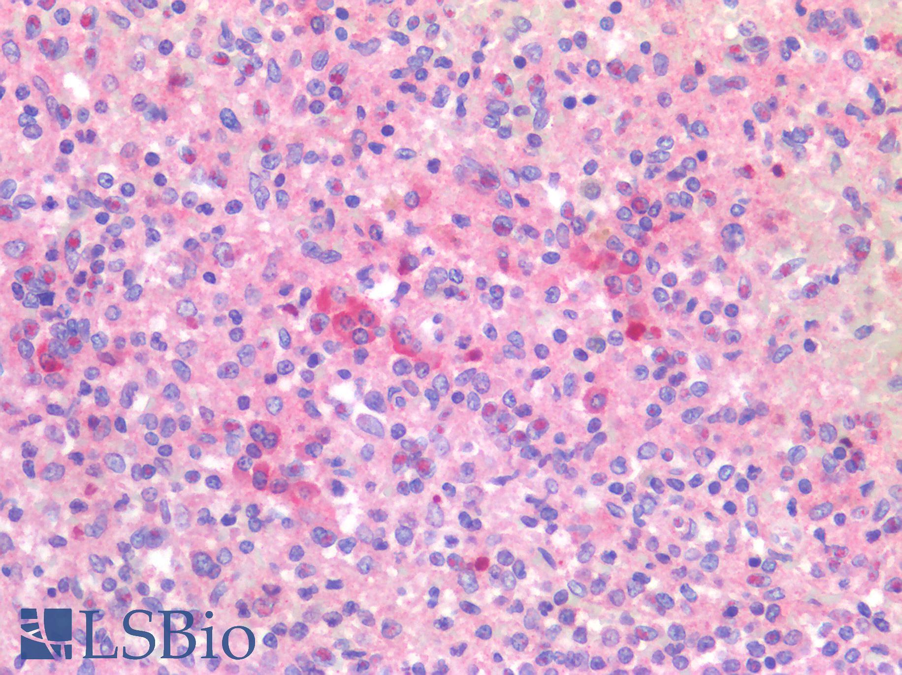 CD40 Antibody - Human Spleen: Formalin-Fixed, Paraffin-Embedded (FFPE)