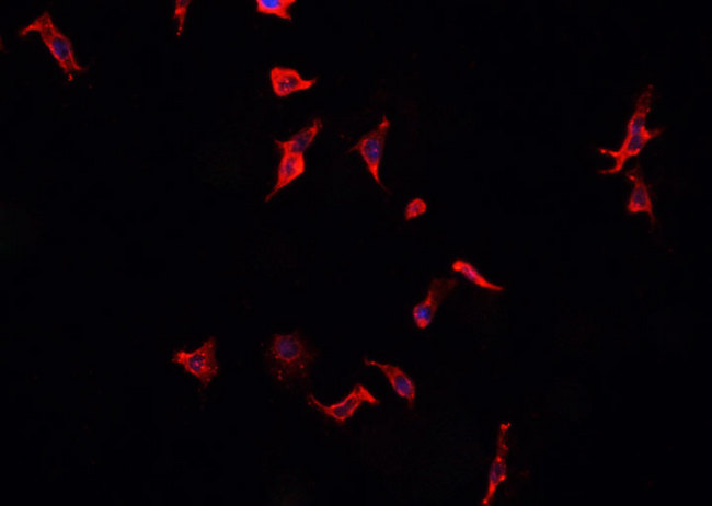 CD40 Antibody - Staining COLO205 cells by IF/ICC. The samples were fixed with PFA and permeabilized in 0.1% Triton X-100, then blocked in 10% serum for 45 min at 25°C. The primary antibody was diluted at 1:200 and incubated with the sample for 1 hour at 37°C. An Alexa Fluor 594 conjugated goat anti-rabbit IgG (H+L) Ab, diluted at 1/600, was used as the secondary antibody.