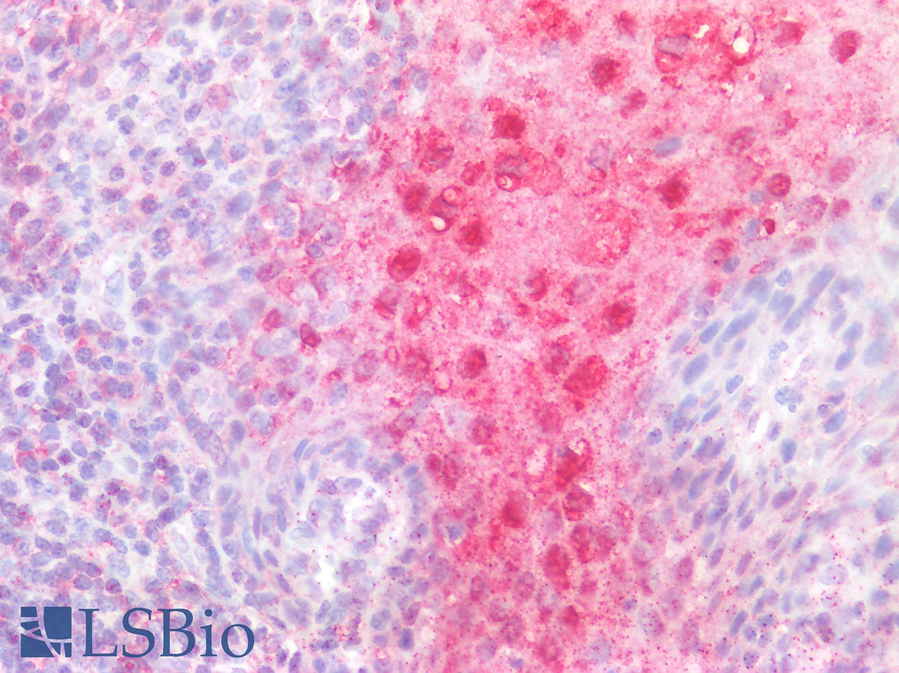 CD40 Antibody - Human Tonsil: Formalin-Fixed, Paraffin-Embedded (FFPE)