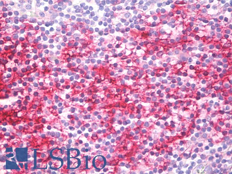 CD40 Antibody - Anti-CD40 antibody IHC staining of human tonsil. Immunohistochemistry of formalin-fixed, paraffin-embedded tissue after heat-induced antigen retrieval.