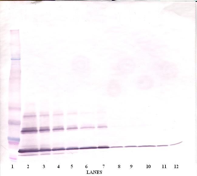 CD40L Antibody - Western Blot (non-reducing) of CD40LG / CD54 antibody