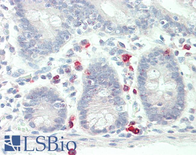 CD40L Antibody - Human Small Intestine: Formalin-Fixed, Paraffin-Embedded (FFPE)