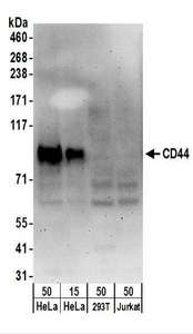 CD44 Antibody - Detection of Human CD44 by Western Blot. Samples: Whole cell lysate from HeLa (15 and 50 ug), 293T (50 ug), and Jurkat (50 ug) cells. Antibodies: Affinity purified rabbit anti-CD44 antibody used for WB at 0.1 ug/ml. Detection: Chemiluminescence with an exposure time of 3 minutes.