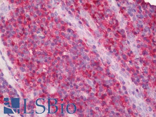 CD44 Antibody - Anti-CD44 antibody IHC staining of human tonsil. Immunohistochemistry of formalin-fixed, paraffin-embedded tissue after heat-induced antigen retrieval. Antibody concentration 2.5 ug/ml.