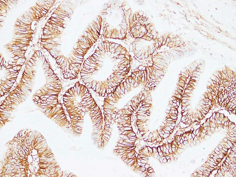 CD44 Antibody - Colon Carcinoma