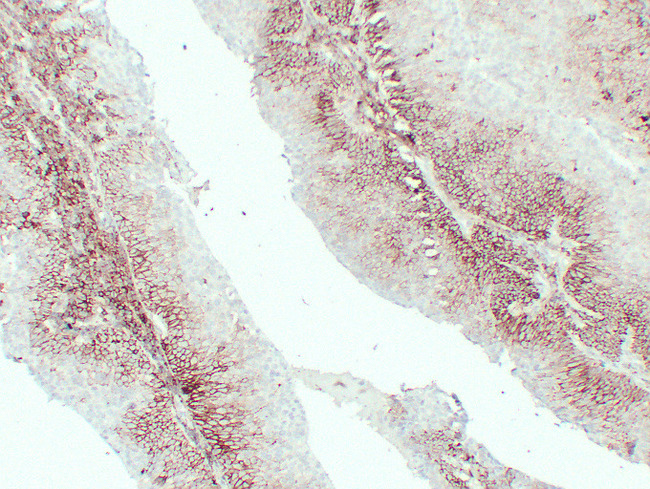 CD44 Antibody - Transitional Cell Carcinoma