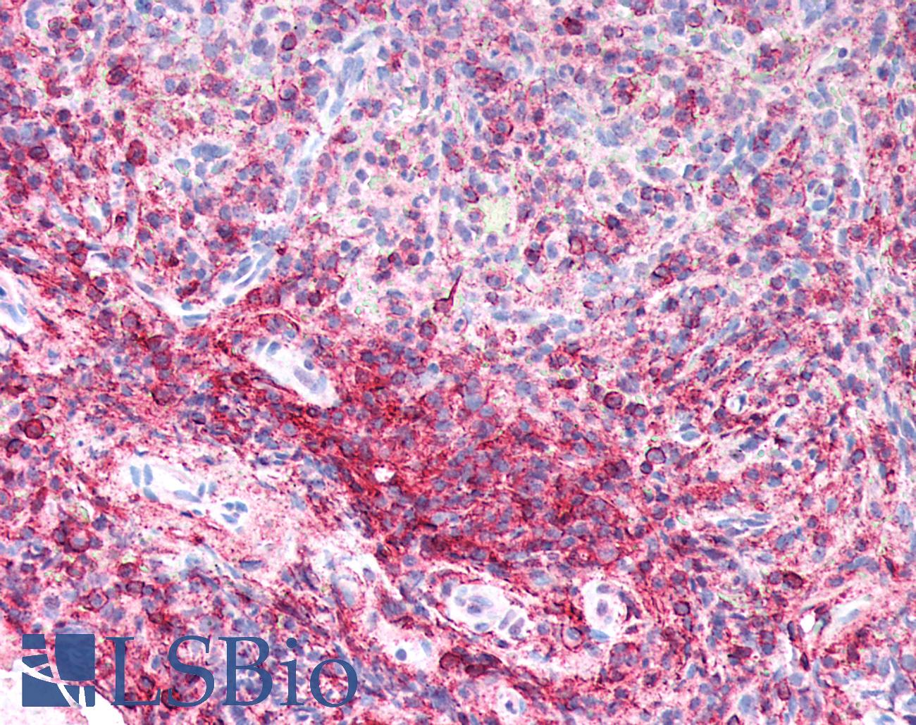 CD44 Antibody - Human Spleen: Formalin-Fixed, Paraffin-Embedded (FFPE)