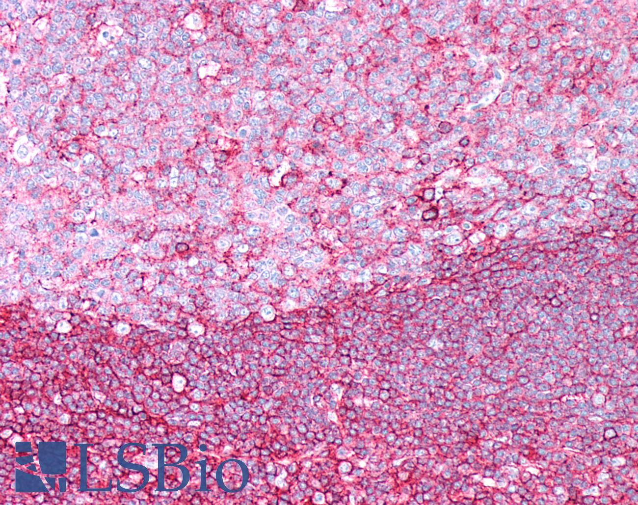 CD44 Antibody - Human Tonsil: Formalin-Fixed, Paraffin-Embedded (FFPE)