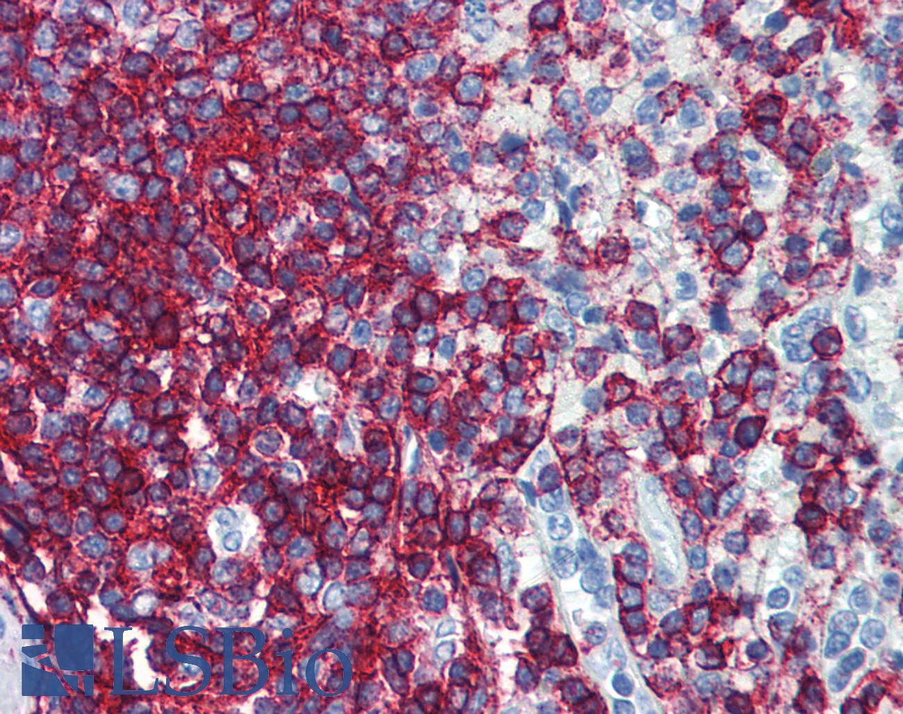 CD44 Antibody - Anti-CD44 antibody IHC of human spleen. Immunohistochemistry of formalin-fixed, paraffin-embedded tissue after heat-induced antigen retrieval. Antibody dilution 1:50. This image was taken for the unconjugated form of this product. Other forms have not been tested.