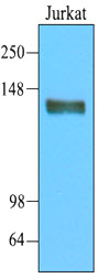CD45 / LCA Antibody - Cell lysates of Jurkat(20 ug) were resolved by SDS-PAGE, transferred to NC membrane and probed with anti-human CD45 (1:2000). Proteins were visualized using a goat anti-mouse secondary antibody conjugated to HRP and an ECL detection system.