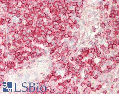 CD45 / LCA Antibody - Human Spleen: Formalin-Fixed, Paraffin-Embedded (FFPE)