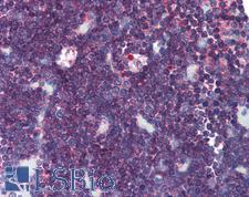 CD45 / LCA Antibody - Anti-CD45 antibody IHC of human thymus. Immunohistochemistry of formalin-fixed, paraffin-embedded tissue after heat-induced antigen retrieval. Antibody dilution 1:50. This image was taken for the unconjugated form of this product. Other forms have not been tested.
