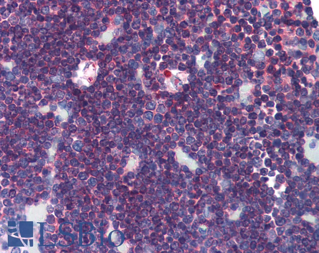 CD45 / LCA Antibody - Anti-CD45 antibody IHC of human thymus. Immunohistochemistry of formalin-fixed, paraffin-embedded tissue after heat-induced antigen retrieval. Antibody dilution 1:50. This image was taken for the unconjugated form of this product. Other forms have not been tested.