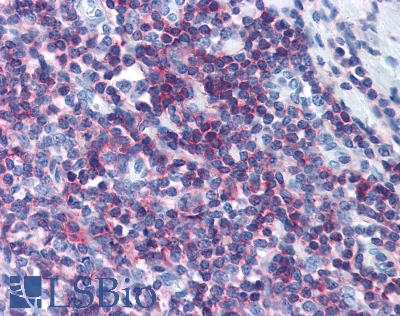 CD45 / LCA Antibody - Anti-CD45 antibody IHC of human tonsil. Immunohistochemistry of formalin-fixed, paraffin-embedded tissue after heat-induced antigen retrieval. Antibody dilution 1:50. This image was taken for the unconjugated form of this product. Other forms have not been tested.