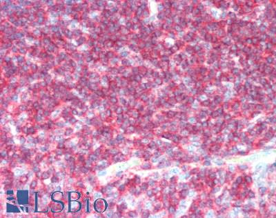 CD45 / LCA Antibody - Human Tonsil: Formalin-Fixed, Paraffin-Embedded (FFPE), at a concentration of 10 ug/ml 