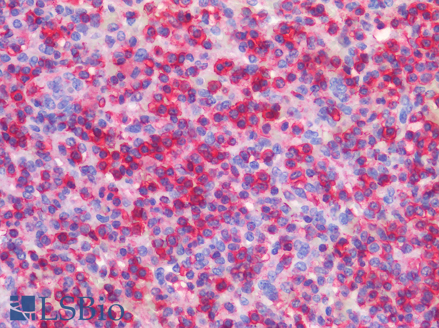 CD45 / LCA Antibody - Human Spleen: Formalin-Fixed, Paraffin-Embedded (FFPE)